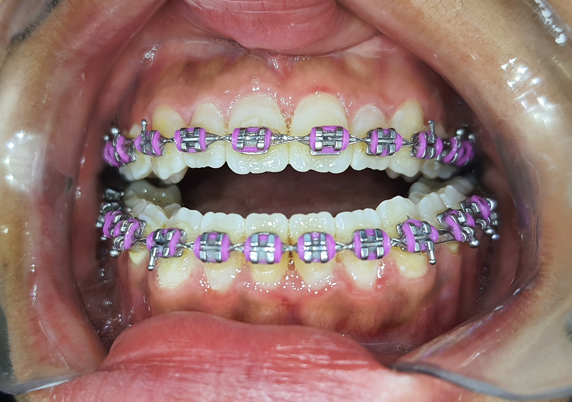 Clínica Odontológica OverClin - Bucomaxilofacial