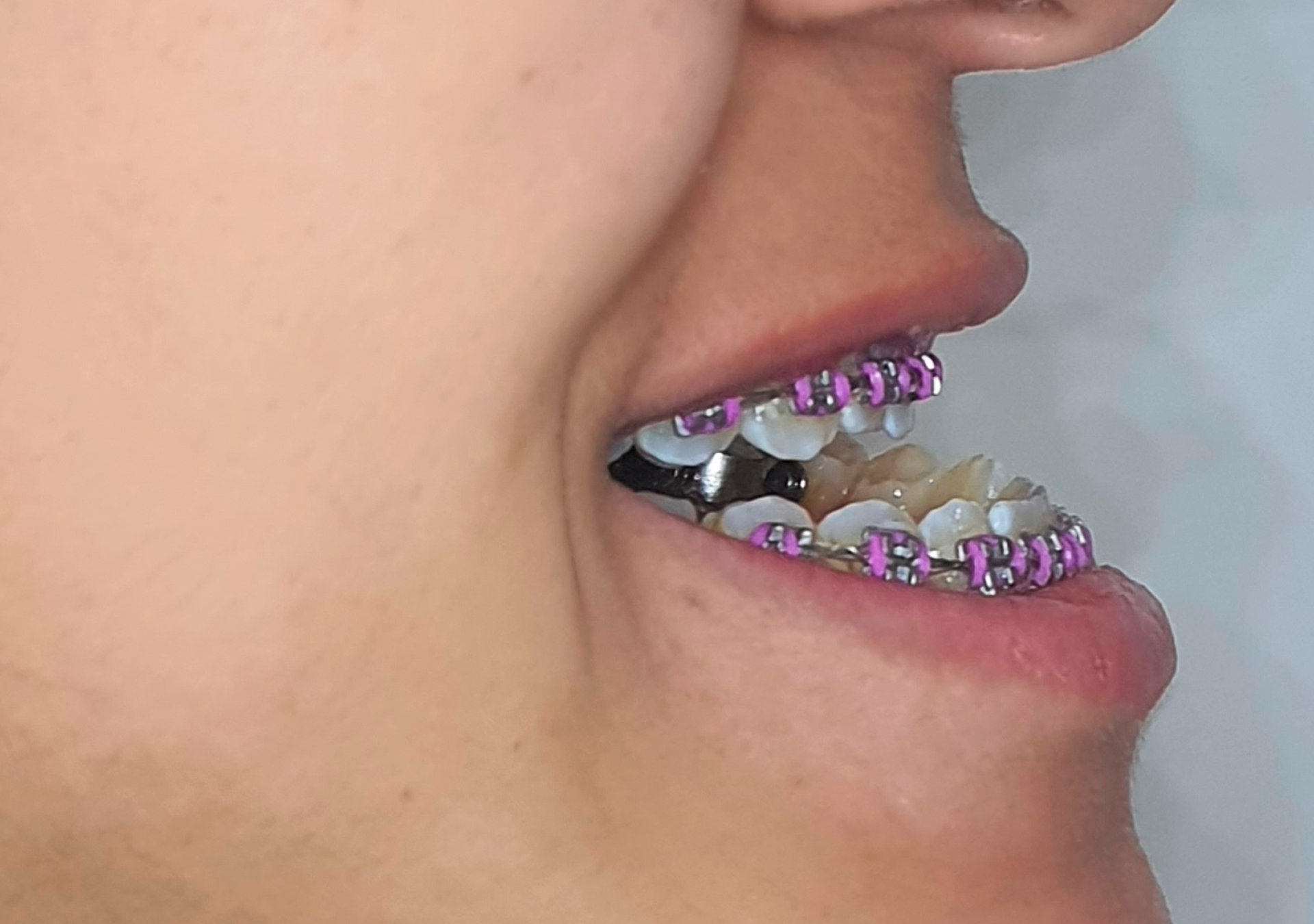 Clínica Odontológica OverClin - Bucomaxilofacial