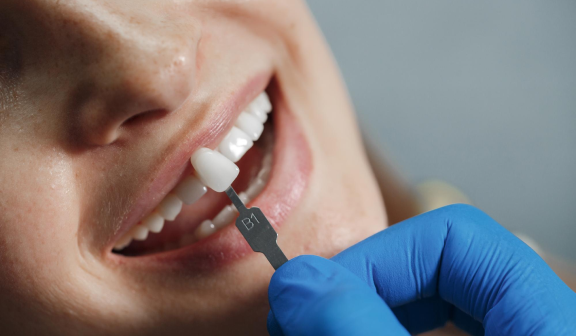 Conheça o nosso tratamento: Facetas