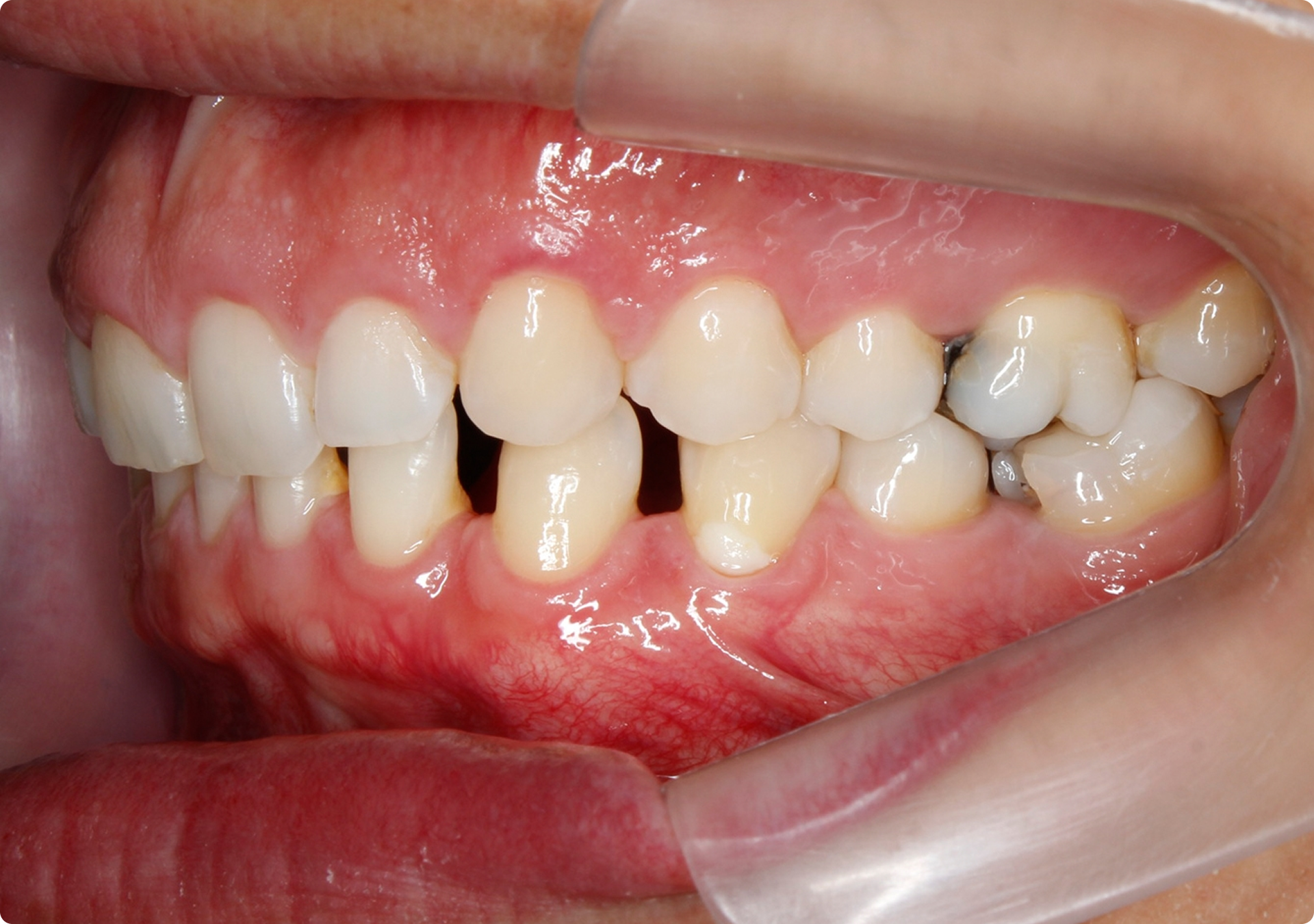 Clínica Odontológica OverClin - Ortodontia