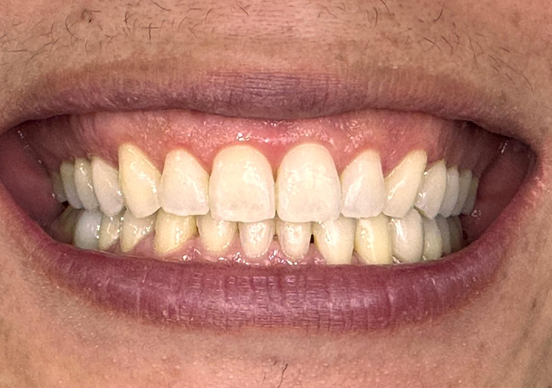 Clínica Odontológica OverClin - Ortodontia