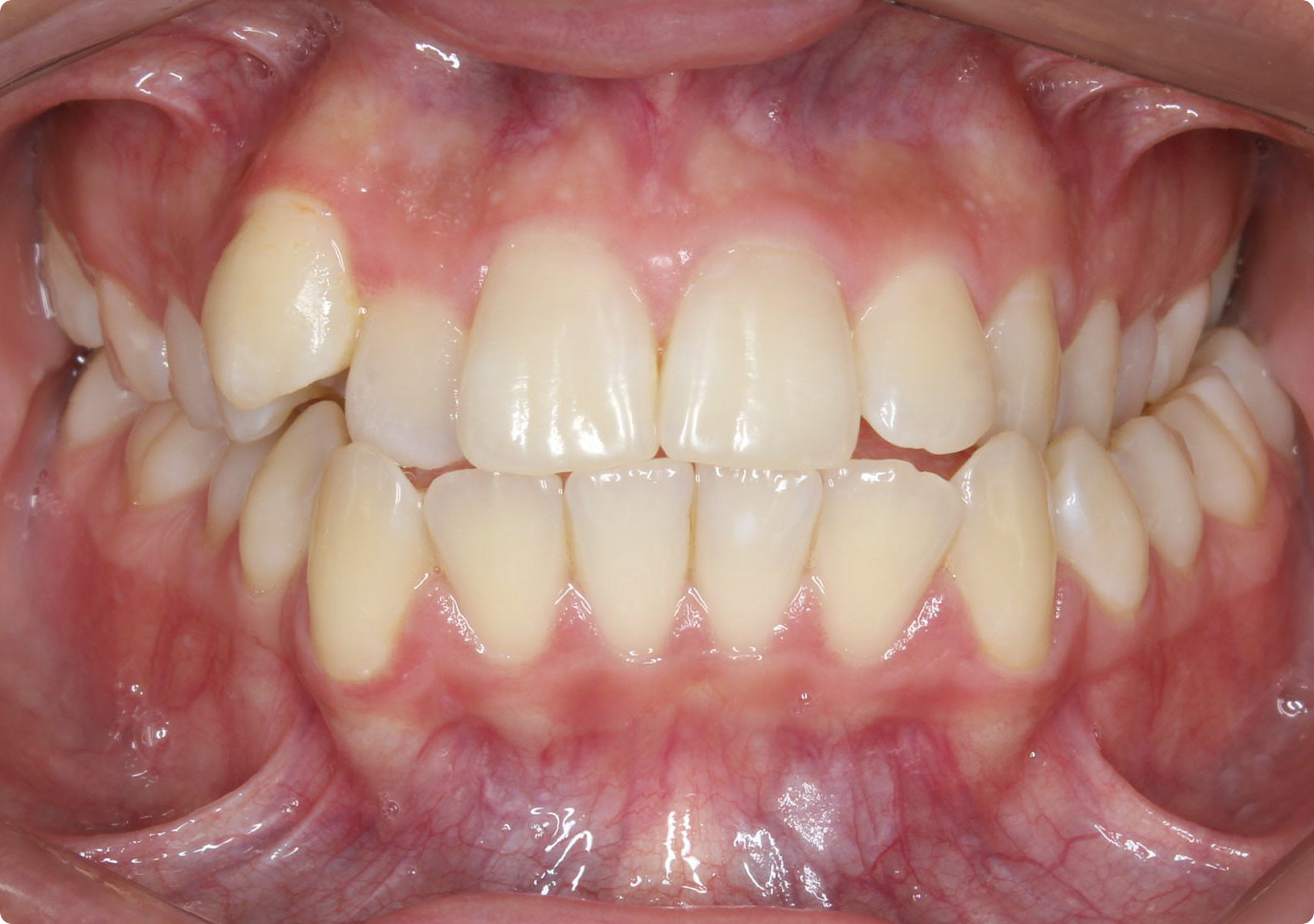 Clínica Odontológica OverClin - Ortodontia
