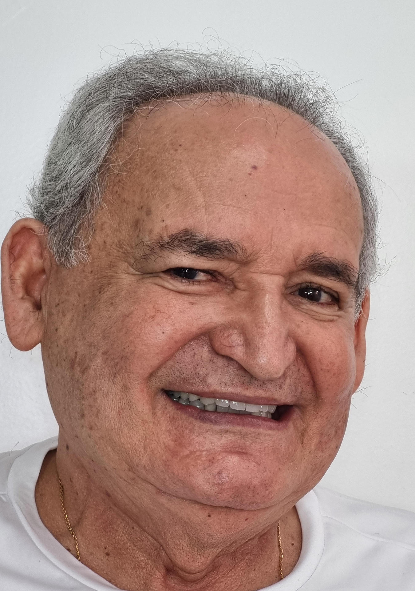 Clínica Odontológica OverClin - Reabilitação Estética