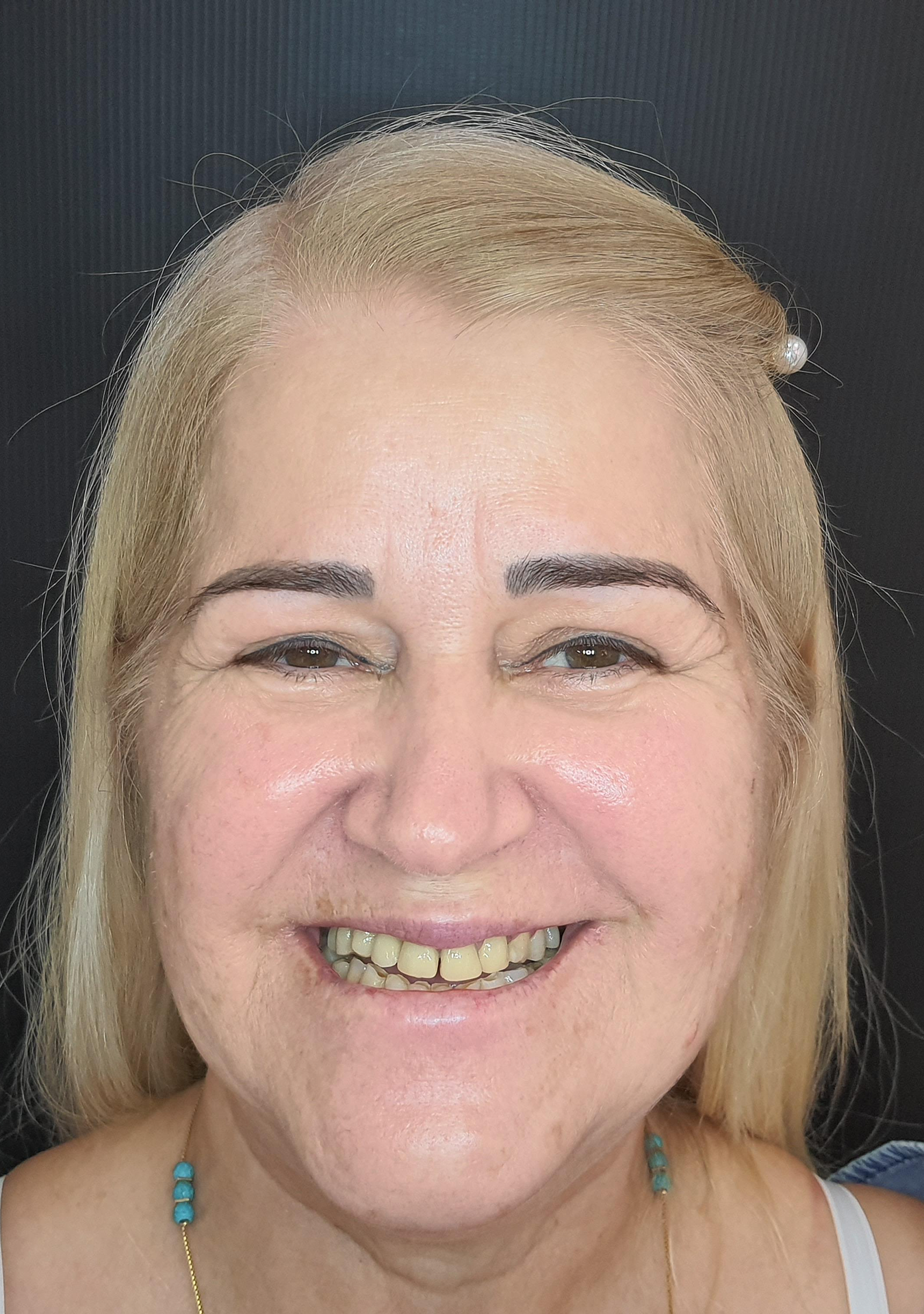 Clínica Odontológica OverClin - Reabilitação Estética