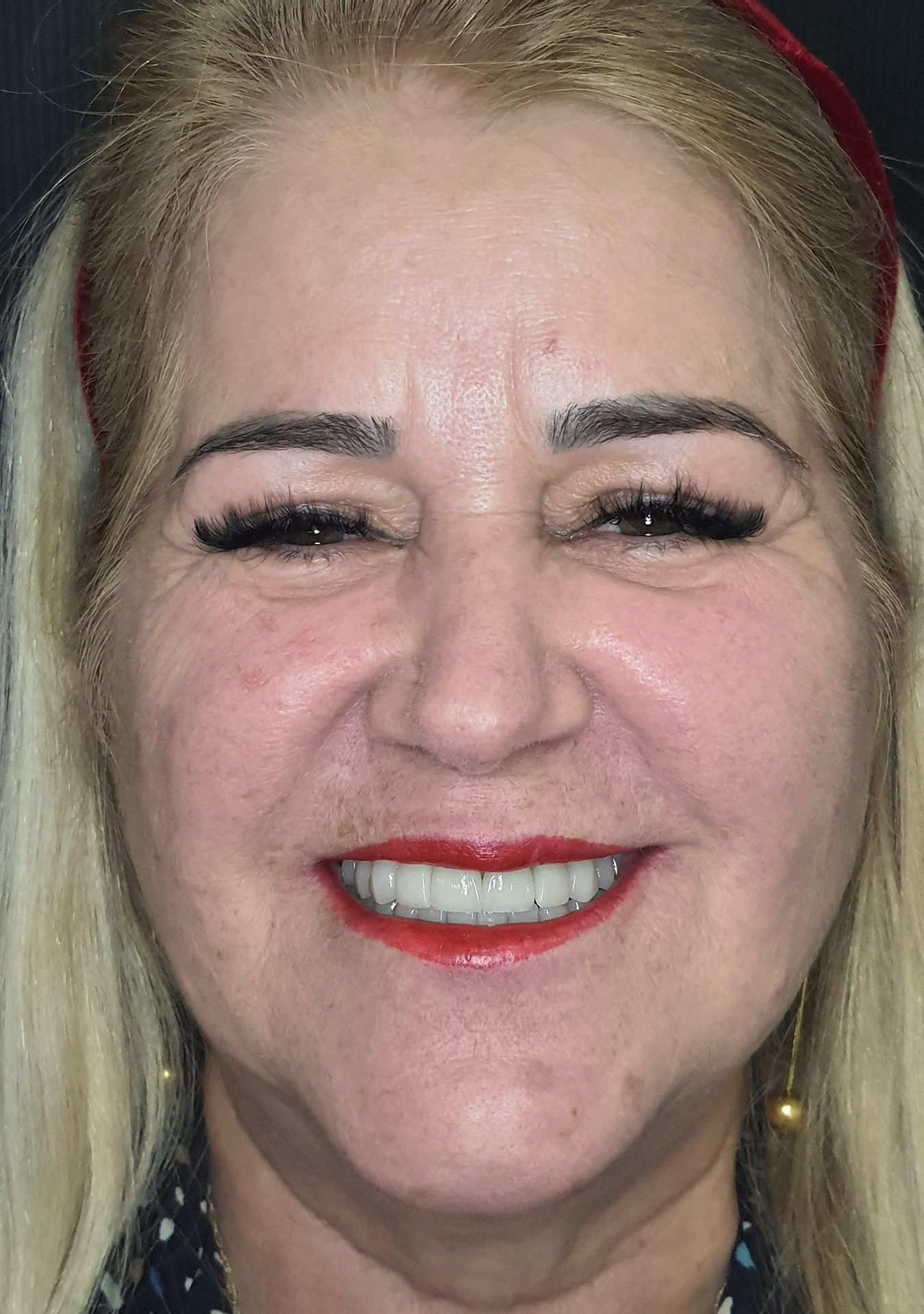 Clínica Odontológica OverClin - Reabilitação Estética