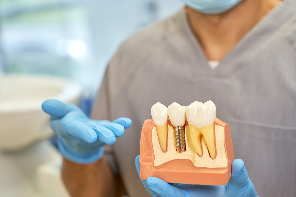 Clínica Odontológica OverClin - Implante Dentário em Santo André: O Guia Definitivo para um Novo Sorriso